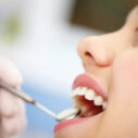 Are You a Candidate for Dental Implants? Here’s How to Know